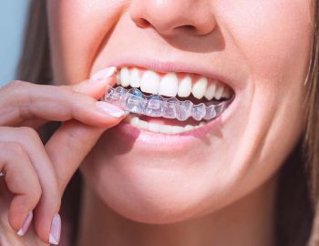 Invisalign London